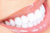 Отбеливание зубов (одна челюсть)